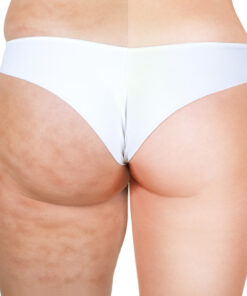 A woman 's buttocks in white panties with no underwear.